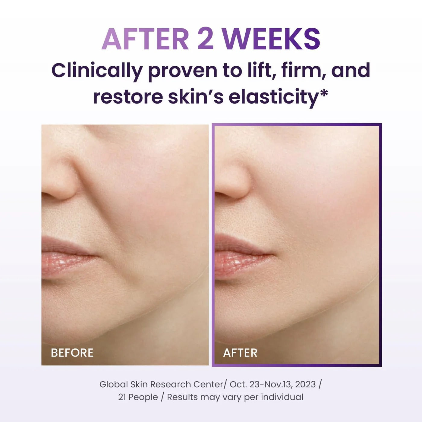 BIOHEAL BOH Probioderm 3D Lifting Cream-50ml