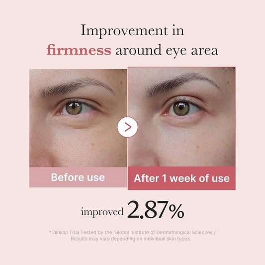 Medicube Pink Eye Cream with PDRN & Peptides (30ml)